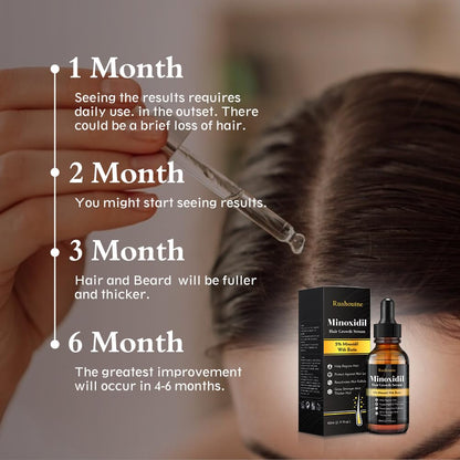 男女兼用5％ミノキシジル育毛トリートメントオイル/ビオチン・ナイアシンアミド配合 Ruahouine Hair Treatment Serum